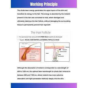 755 808 1064nm OEM Diode Laser Hair Removal Device for Ozero Khanka Pioneer