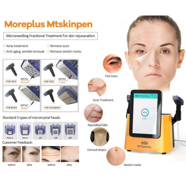 2 PCS Nano-L RF Heads Microneedle RF Device for Effective Face Lifting and Wrinkle Reduction Beauty Treatment