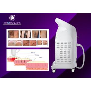 Permanent Hair Removal 808nm Diode Laser Hair Removal Beauty Machine