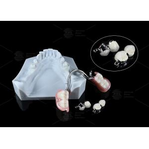 Adjustable Multi Functional ERA Precision Attachment Removable ERA Attachments