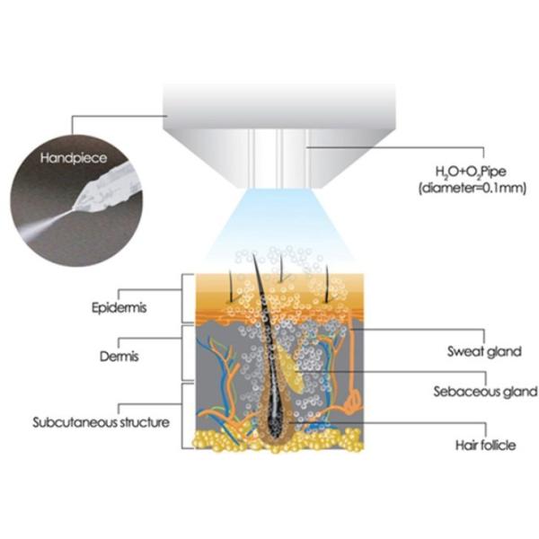 Water Oxygen / Microdermabrasion 3 In 1 E-Light IPL RF Machine MED-370+