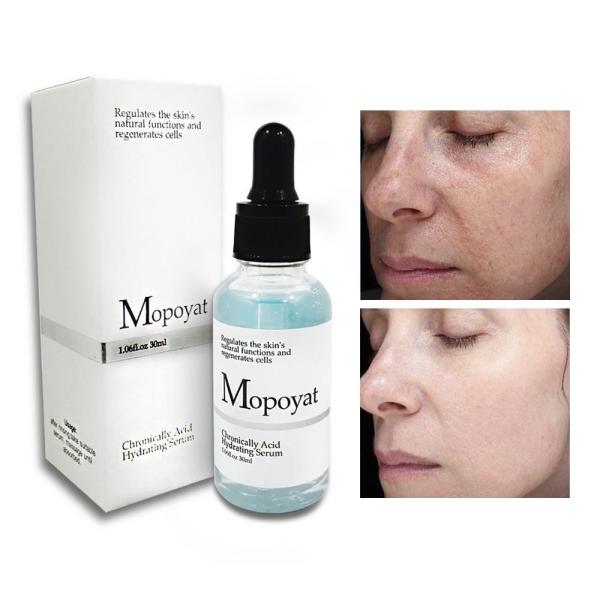 Buy Mopoyat hyaluronic Acid Serum at wholesale prices