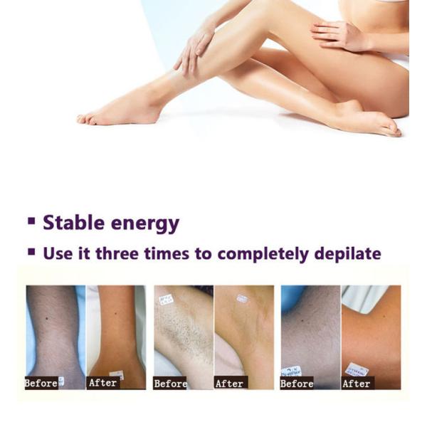 Opt Nd Yag Laser RF Beauty Parlour Products Hair Removal