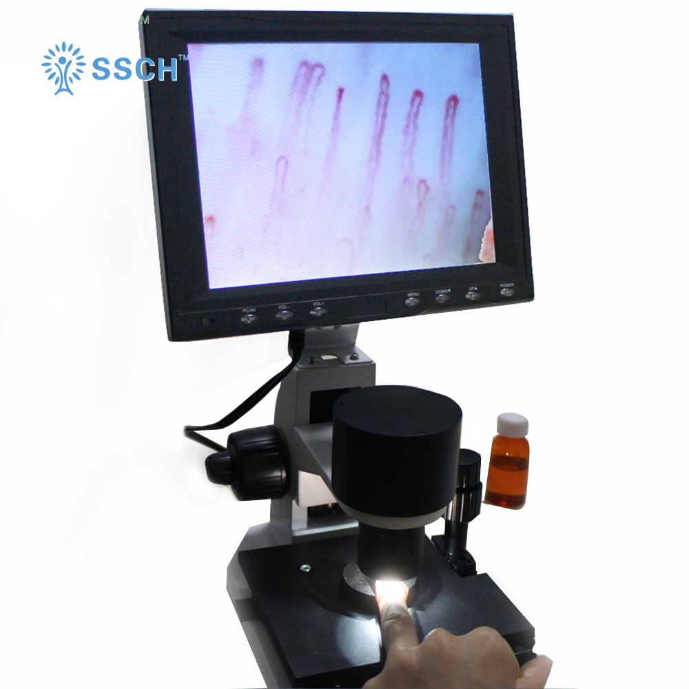 Capillaroscope Microcirculation Microscope Built - In Camera 380 000 Pixels GY