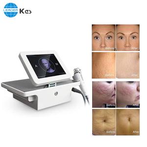 Quality 4MHz Fractional Rf Microneedling Machine For Skin Rejuvenation for sale