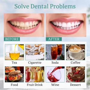 Activated Charcoal Teeth Whitening Bleaching Kit 100ml With Tooth Powder