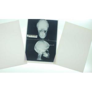 China Konida 10in X 12in X Ray Medical Imaging on sale