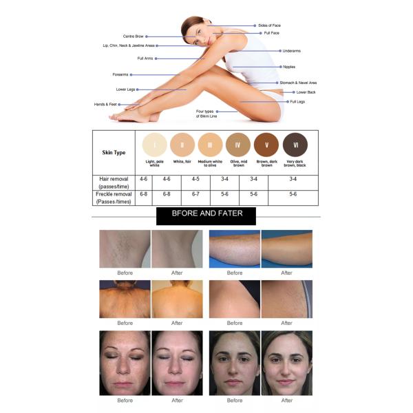 Beauty IPL Laser Radio Frequency Slimming Equipment with Drive Power 1200W