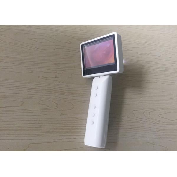 Mini Portable Digital Video Otoscope Record Photographs / Videos For Ear Nose Checking