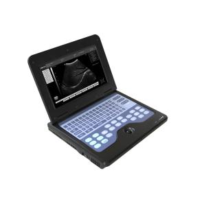 CMS600P2 B-Ultrasound Diagnostic System
