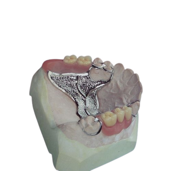 Buy Custom OEM Cast Removable Partial Denture High Strength Digitization Design at wholesale prices
