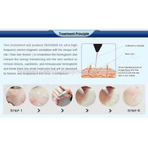 30hz high frequency Immediately result 8.4Inch touching screen spider vein