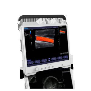 15 Inch LCD Screen 2D Colour Doppler Machine Test Digital With Wide Angle