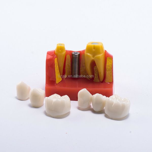 Class III Instrument Classification Dental Study Model for Dental Practice and Demonstration