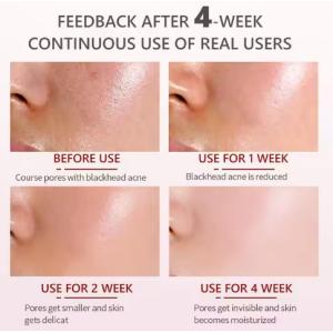 High Quality Brightening Essence Moisturizing Nourishing Whitening Anti-Wrinkle