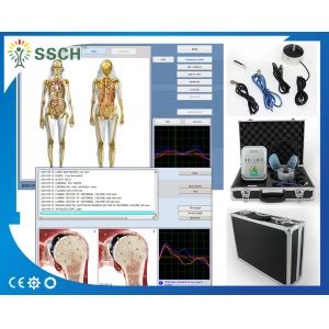 China Bioresonance Therapy Health Analyzer Machine , Quantum Bio feedback on sale