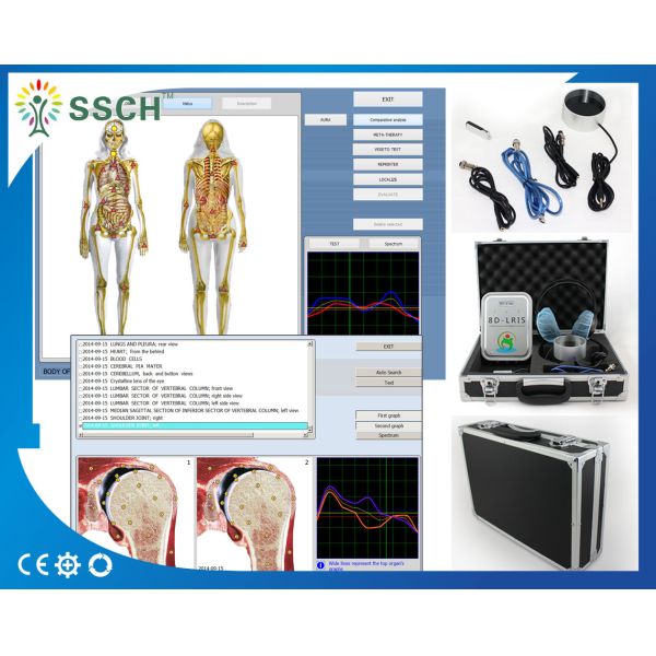 Buy Bioresonance Therapy Health Analyzer Machine , Quantum Bio feedback at wholesale prices