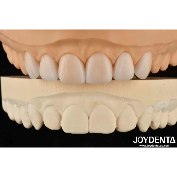 Lightweight Property Flexible Denture Finish Personalized Customization For
