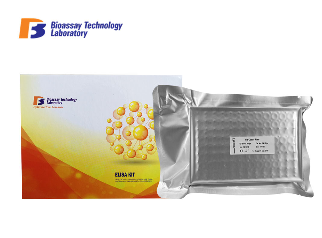 Quality AFP Sandwich Mouse ELISA Kit With Standard Solution And Diluent for sale