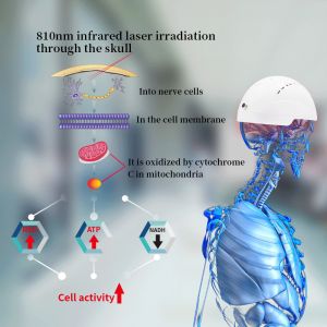 Medical Brain Rehabilition Infrared Transcrial Neuron Injury Physiotherapy