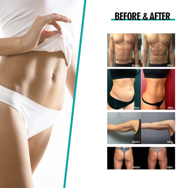 Med-380 Uni Machine Neo With Rf Machine Certificate