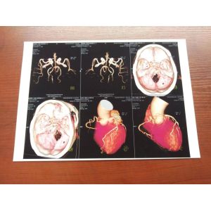 A4 Toner Laser Printing Film