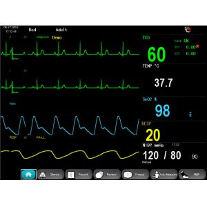 Dual-Channel 12 Inch High Definition Color TFT Display Standard 6-parameter E12