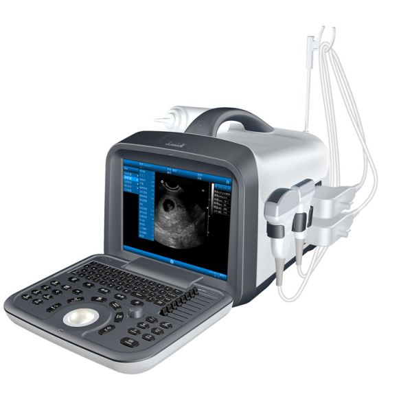 Buy 2021 Top Selling Medical Ultrasound Instruments, Portable B&w Ultrasound Scan Machine for Hospital at wholesale prices