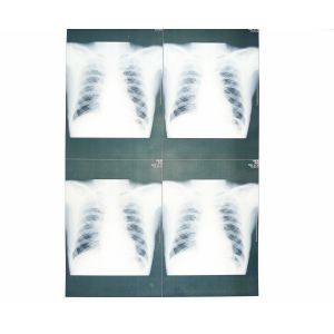 Wearable White Base Medical X Ray Films , Medical Imaging X-ray Paper Film
