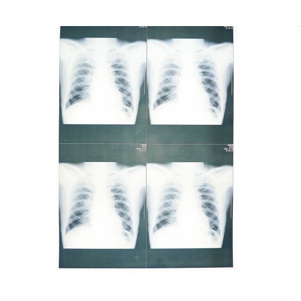 Wearable White Base Medical X Ray Films , Medical Imaging X-ray Paper Film
