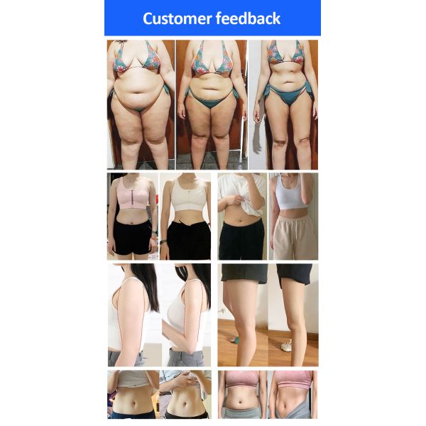 EMS Cooling Beauty Therapy Machine Fat And Cellulite Reduction Machine