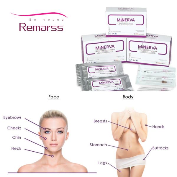 Buy famous korean brand minerva mono cog spring tornado screw cog fishbone v line for more collagen anti aging pdo thread li at wholesale prices