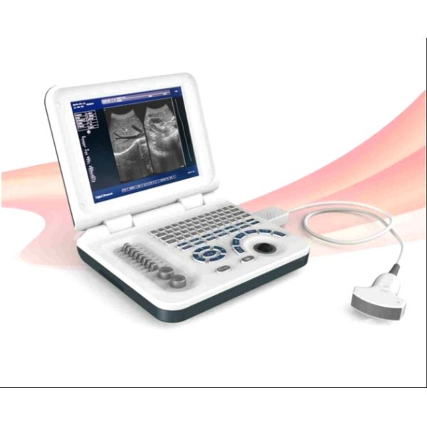 Buy Diagnostic Laptop Ultrasound Machine Digital Ultrasound Scanner Durable at wholesale prices