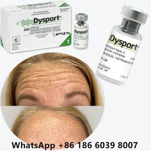 Botulinum Toxin Dysport 100u Botox Injection For Nasal Dorsum Wrinkles Effective