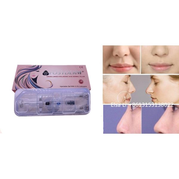 1ml 2ml cosmetic dermal filler For Deep Wrinkles HA Gel Injection CE