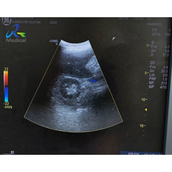 Buy GE 4C-RS Convex Probe Ultrasound Transducer Lens Replacement at wholesale prices