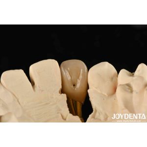 0° Angulation Finished Dental Abutments 1.5mm Thread Pitch Polished Surface