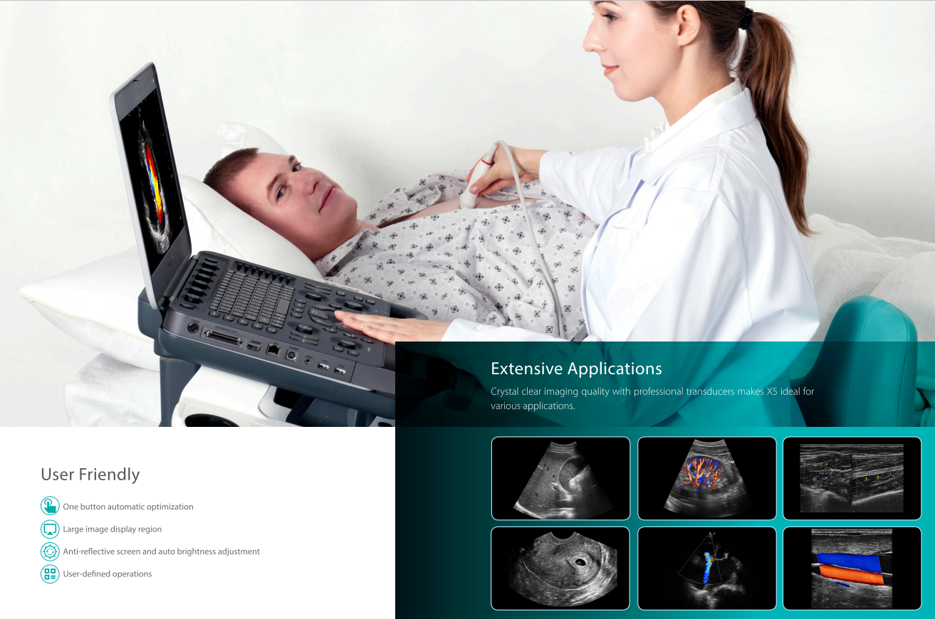 Sonoscape X5 Medical Ultrasound Instruments Machine with Excellent Image Quality