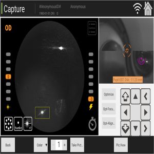 Manual Digital Fundus Camera Ophthalmology Coherence Tomography