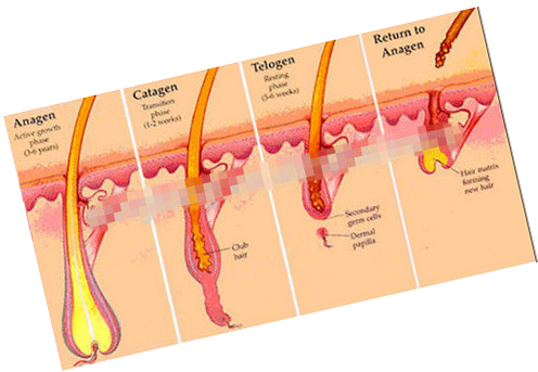 Peak Power 1400W RF E light IPL machine with FDA 510K approved with 250W