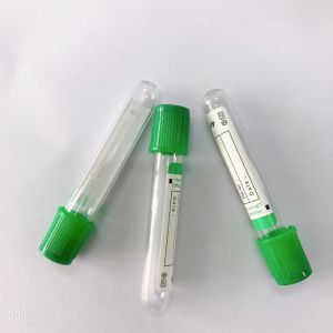 Green-Top Lithium Heparin Tube with Additive/Non-Additive for Routine Chemistry Tests