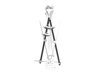 Buy Ankle Joint External Fixation System Customized Design OEM / ODM Service at wholesale prices