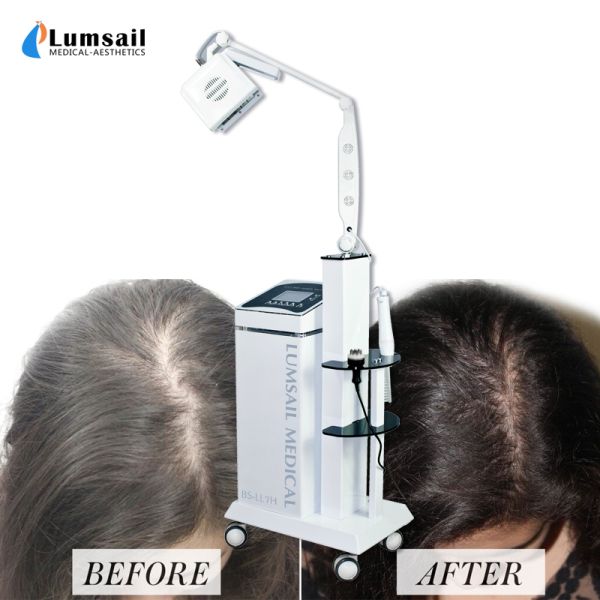 650nm 670nm Hair Regrowth Diode Laser Machine Energy Adjustable