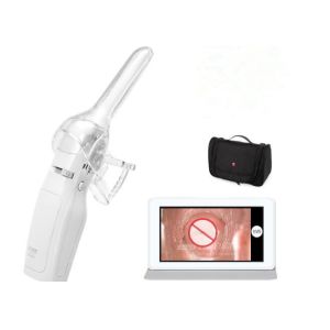 Cervix Camera Video Camera for Vaginal Handheld Digital Mini Colposcope Self -