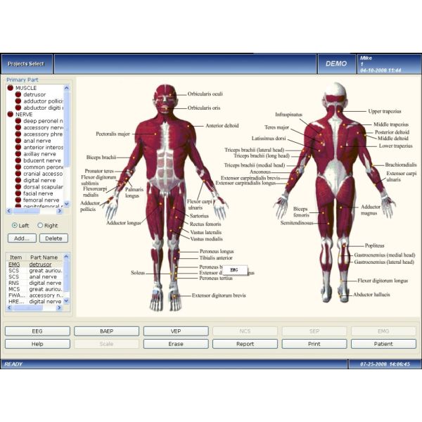 CONTEC CMS6600B Mobile Ultrasound Machine PC Based 4 Channel EMG / EP System