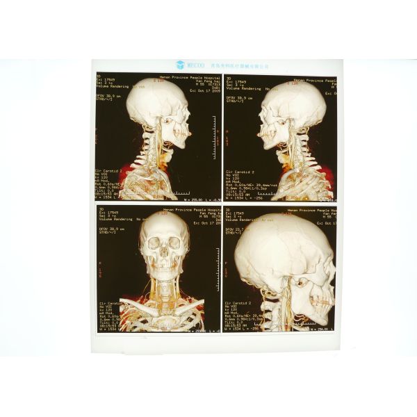 Buy High Density Medical X Ray Film Blue For Konida Laser Printer at wholesale prices