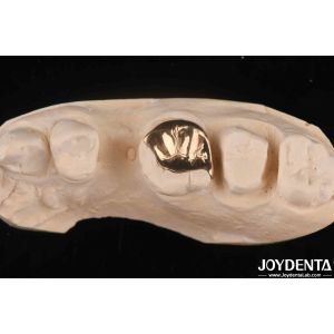 Custom Oral Clinical Wear Resistant Gold Dental Crown With 60K Metallic