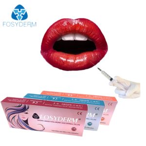 Hyaluronic Acid Dermal Filler With Lidocaine 1ml Lip Augmentation