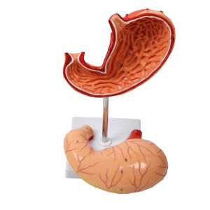 Anatomy Human Organs Gastric Diseased Dissection Stomach Teaching Model