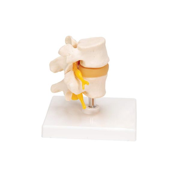 Buy 0.45kg Medical Anatomy Education 20x16x10cm Lumbar Spine Model at wholesale prices